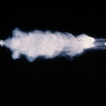 62-годишен живее с куршум в главата 6 години. Виновни - няма