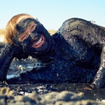 Пациенти на Тузлата се оплакват от змии и лош път до болницата