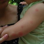 Добричлии да затворят прозорците си – ще пръскат против комари